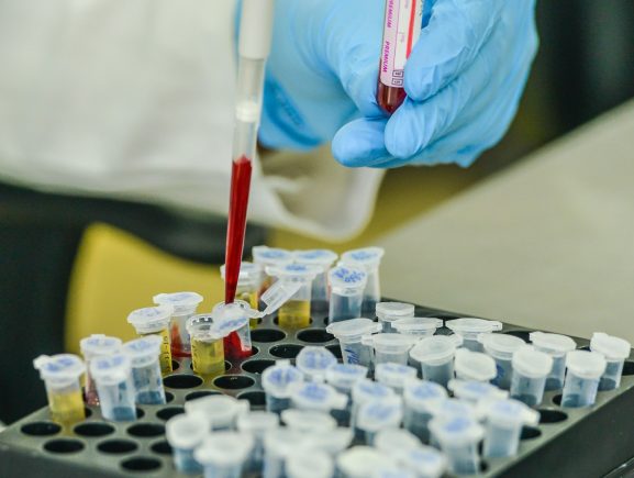 Fundação de Medicina Tropical participa de estudo internacional sobre Tuberculose