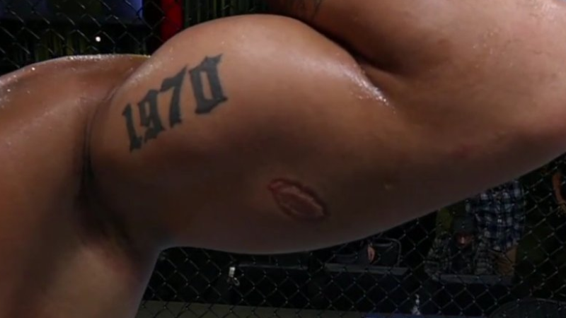Brasileiro é demitido do UFC após mordida no adversário durante luta
