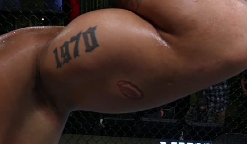 Brasileiro é demitido do UFC após mordida no adversário durante luta