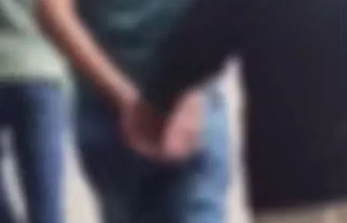 Mulher é agredida com barra de ferro por companheiro usuário de drogas em Manaus