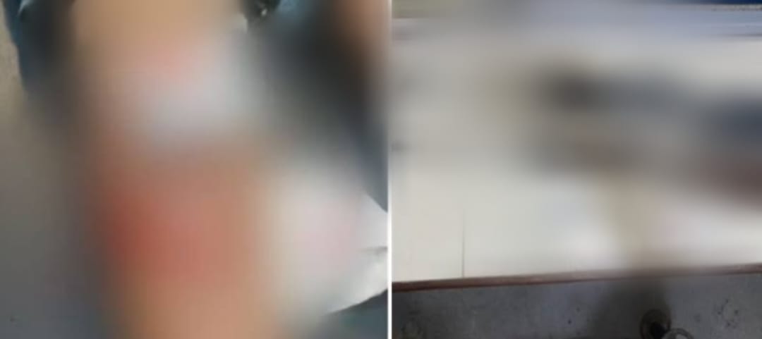 Homem é baleado com um tiro de espingarda no interior de Autazes