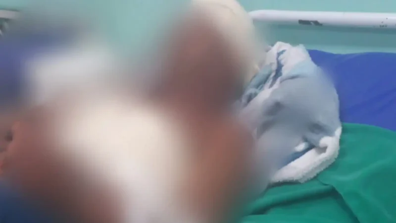 Galho de árvore cai na cabeça de homem que é socorrido e levado para Autazes