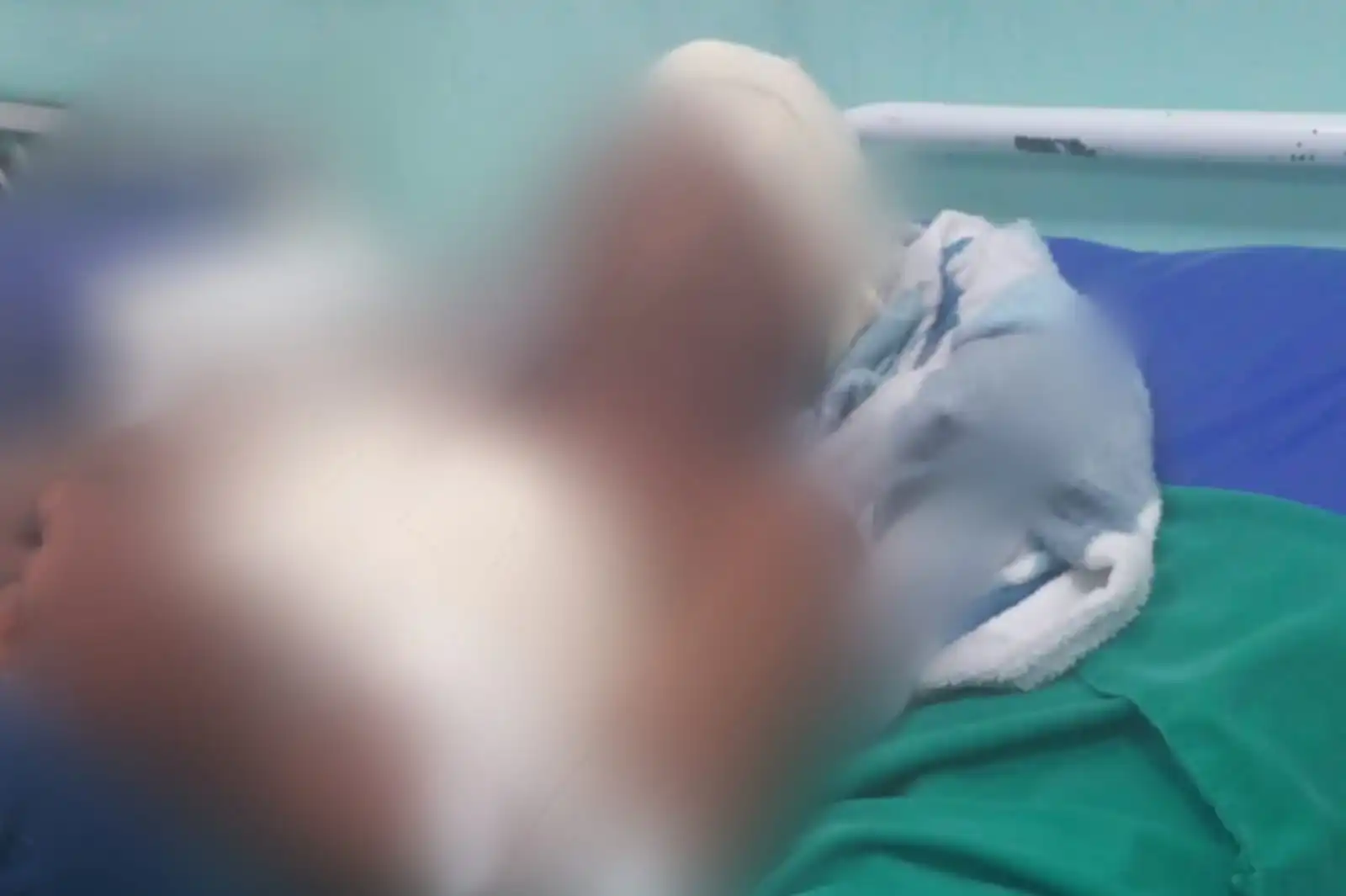 Galho de árvore cai na cabeça de homem que é socorrido e levado para Autazes