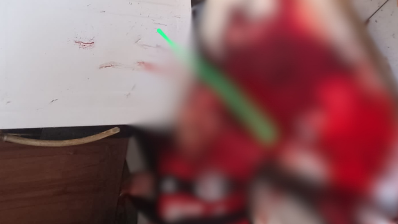 Homem é assassinado e fica com a cara desfigurada em Manaus