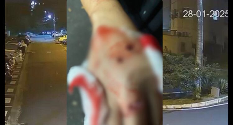 Câmeras flagram ataque de pitbull a jovens dentro de condomínio em Manaus; veja