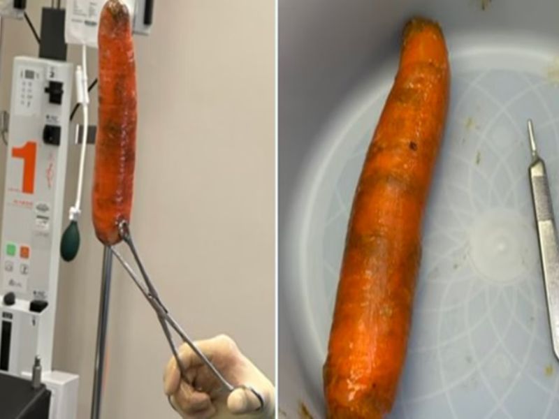 Homem vai parar na emergência com “cenourão” enfiado no ânus