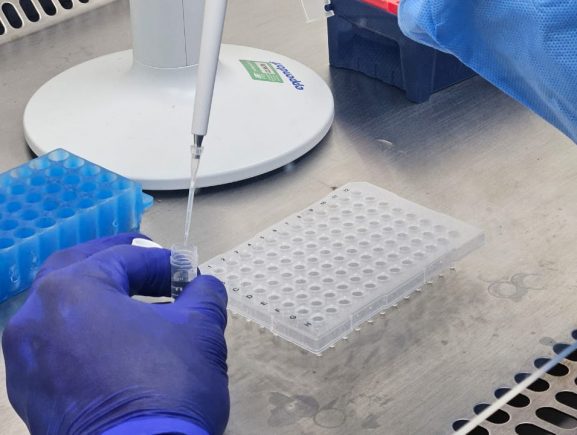 Saúde Estadual registra redução de casos e óbitos no informe de Vírus Respiratórios no Amazonas