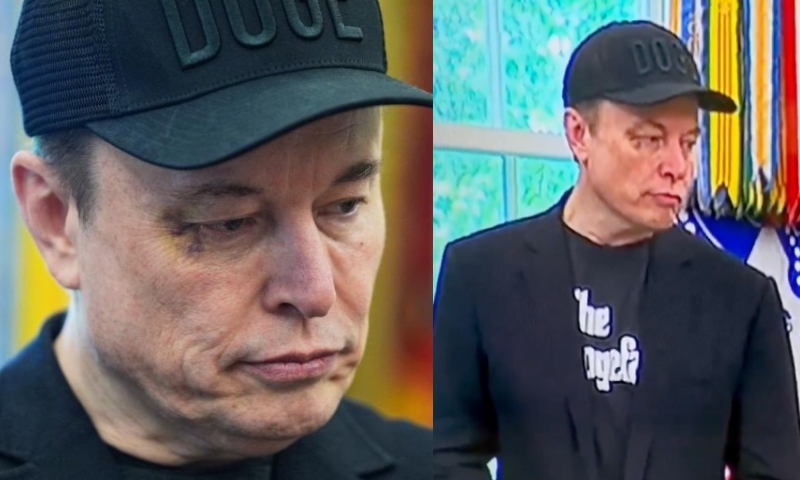 Elon Musk aparece com olho roxo após despedida oficial do Governo Trump