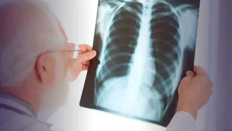 Pneumonia em idosos: conheça as causas e riscos