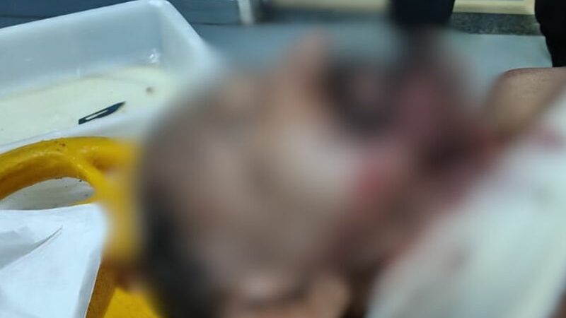 Assaltantes degolam idoso no Amazonas