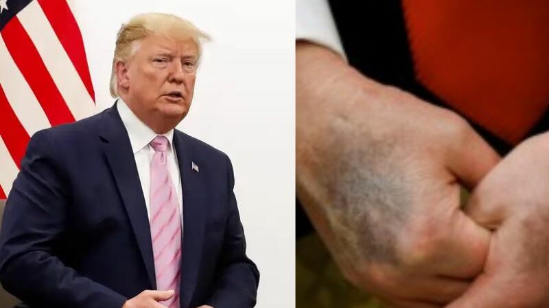 Suposta morte de Donald Trump gera especulações e memes no X