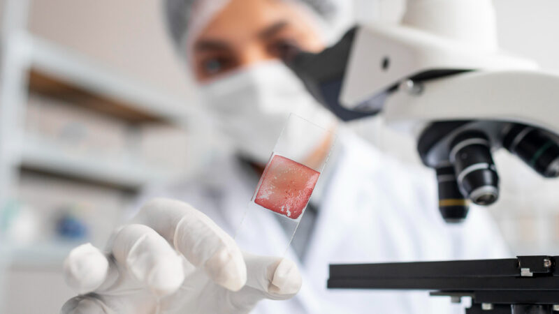 Homem Entra em Remissão do HIV após Transplante de Células-Tronco