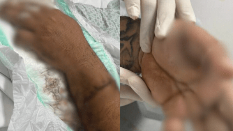 Motorista de app perde dedo após ser atacado por passageiro com terçado em Manaus