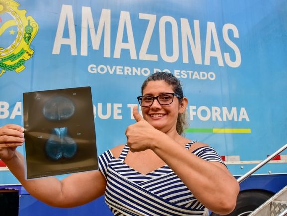 Governo do Amazonas oferta cirurgias ginecológicas e exames para mais de mil mulheres, neste fim de semana