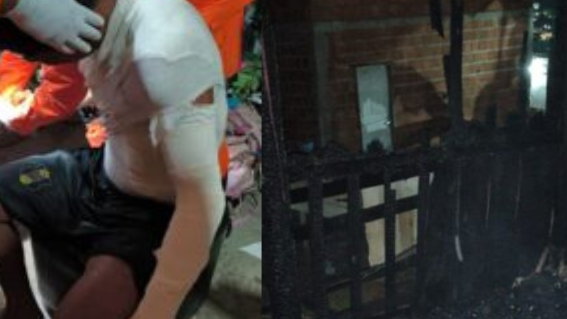 Vazamento em botija de gás provoca incêndio e deixa homem com corpo queimado, em Manaus